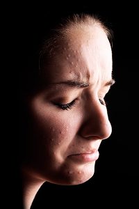 Alternative Therapies For Depression - Image of Woman Crying