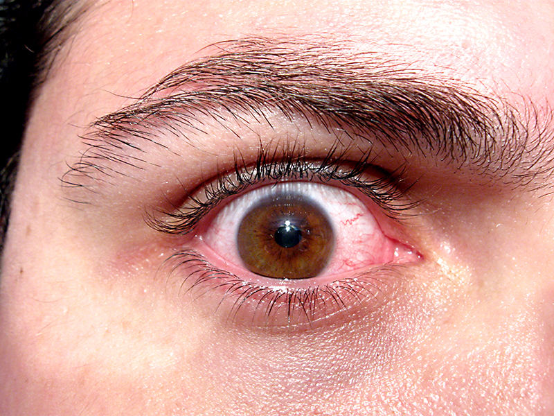 Image of man's eye wide with panic and anxiety